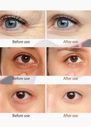 Microcurrent EMS Eye Beauty Massager